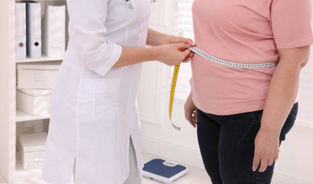 BMI of an obese person