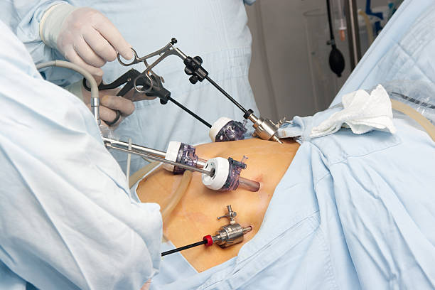 bariatric surgery for weight loss